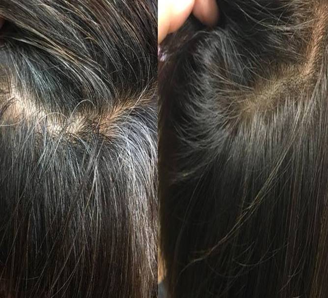 Nhuộm tóc đen cho người lớn tuổi sẽ giúp giữ vẻ trẻ trung và tươi tắn cho mái tóc của bạn. Tuy nhiên, chọn lựa loại thuốc nhuộm tóc đúng là điều quan trọng để không làm hư hỏng mái tóc của bạn. Hãy xem hình ảnh để biết thêm về các loại thuốc nhuộm tóc an toàn và phù hợp cho người lớn tuổi.