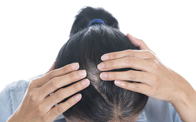 Không còn phải lo lắng về những sợi tóc bạc trên đầu, người lớn tuổi sẽ thấy mình trẻ trung hơn với thuốc nhuộm đen chuyên dành cho họ. Thuốc nhuộm tóc đen này còn giúp tóc bạn phục hồi sức sống và chống lại quá trình lão hóa tóc.